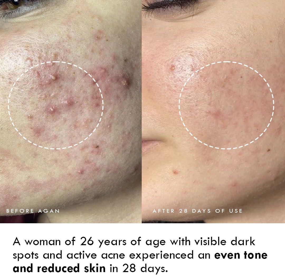 AULI LIFESTYLE Hello Hydration Cream/Moisture BOOST GEL Cream/Licorice + Fenugreek + Almond (Badam Taila) + Madujam (Beeswax) + Vitamin a & E + Glycerin image number 5