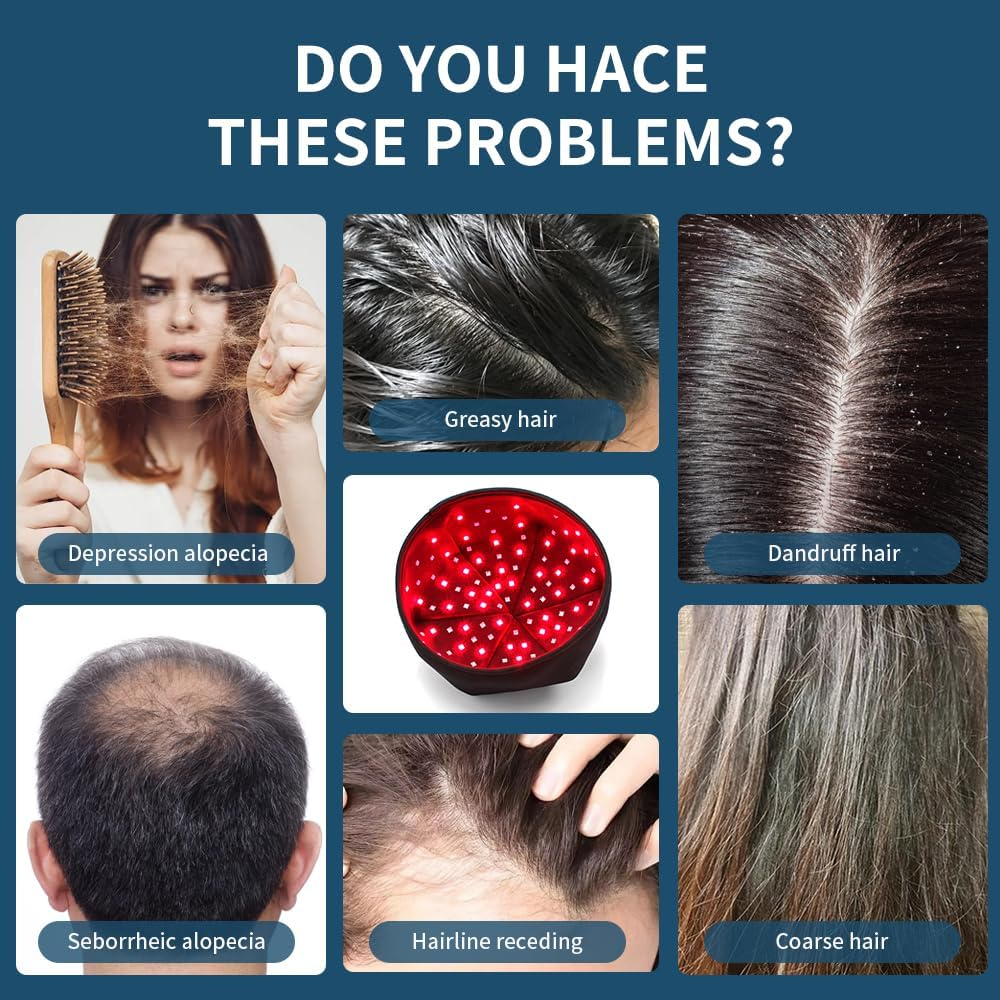 Red Light Hair Growth Beanie, Revitalize Your Hair with the Power Laser Hair Growth Cap, Red Light Laser Hair Growth Cap, Red Light Hair Growth Hat(Black Plug-In)