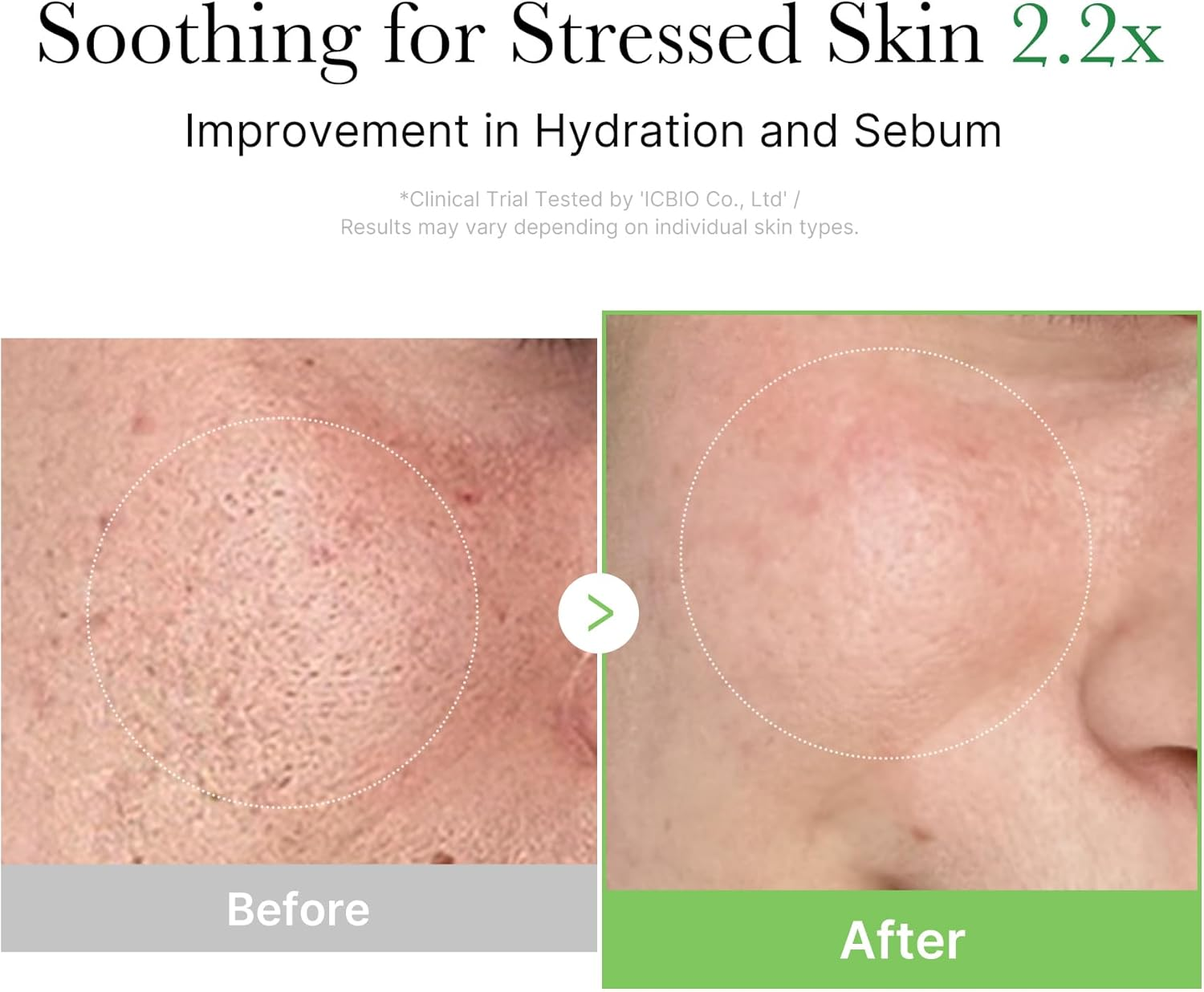 MEDICUBE - Exosome Cica Cream 50 Ml image number 2