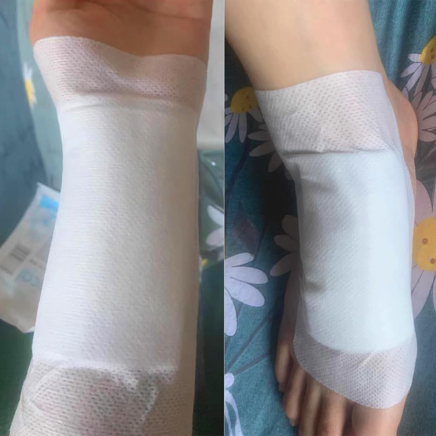 Wound Dressings Adhesive, Large Dressing Pads Padding with Absorbent Patch, Individually Wrapped(10 X 25Cm, 10 Pack) image number 6