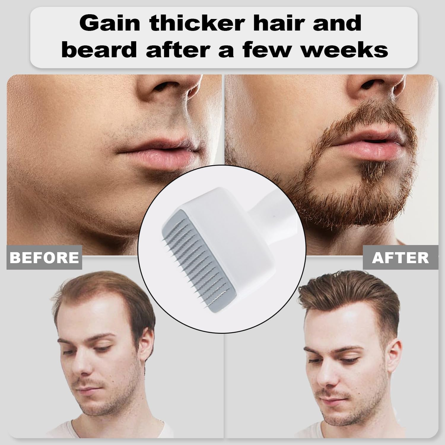 Simofuze Derma Stamp, Professional Derma Roller, 0-3Mm Adjustable Microneedling, 140 Needles Dermastamp, for Hair and Beard Growth, Improve Skin Condition, for Women and Men image number 3