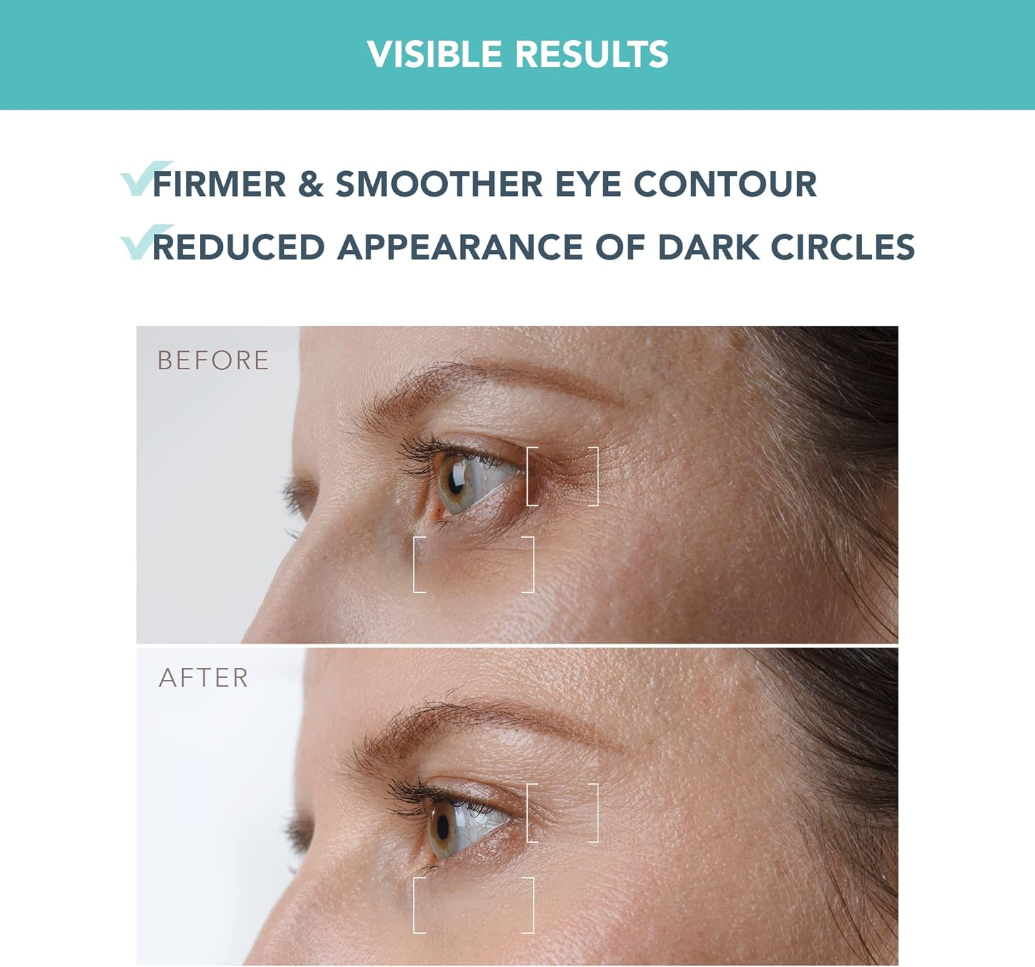 FOREO IRIS Firming PM Eye Serum - Retinol - Mushroom Extract - Vitamin E - Bakuchiol - Travel Size Eye Treatment Products - for Dark Circles, Wrinkles & Eye Bags - Fragrance Free - 15Ml image number 6