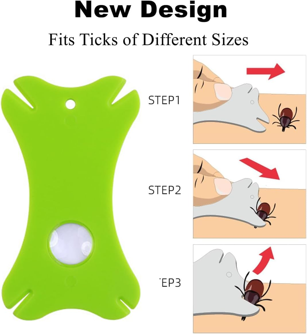 AIMALL 5PCS Tick Removal Kit for Pets, Dog Lice Fork, Flea Hook, Insect Catch Tweezers Set, Professional Pet Grooming Tool image number 1