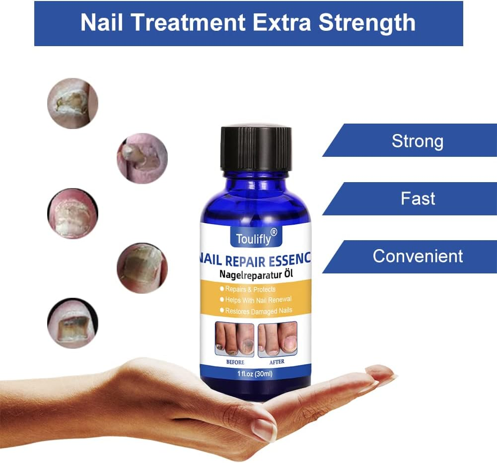 Nail Care and Treatment, Nail Repair, Nail Care for Healthy Foot and Hand, Nail Oil, Nail Care Oil, Nail Care Nourishing, Nail Essence Serum, for Broken and Discoloured Nails