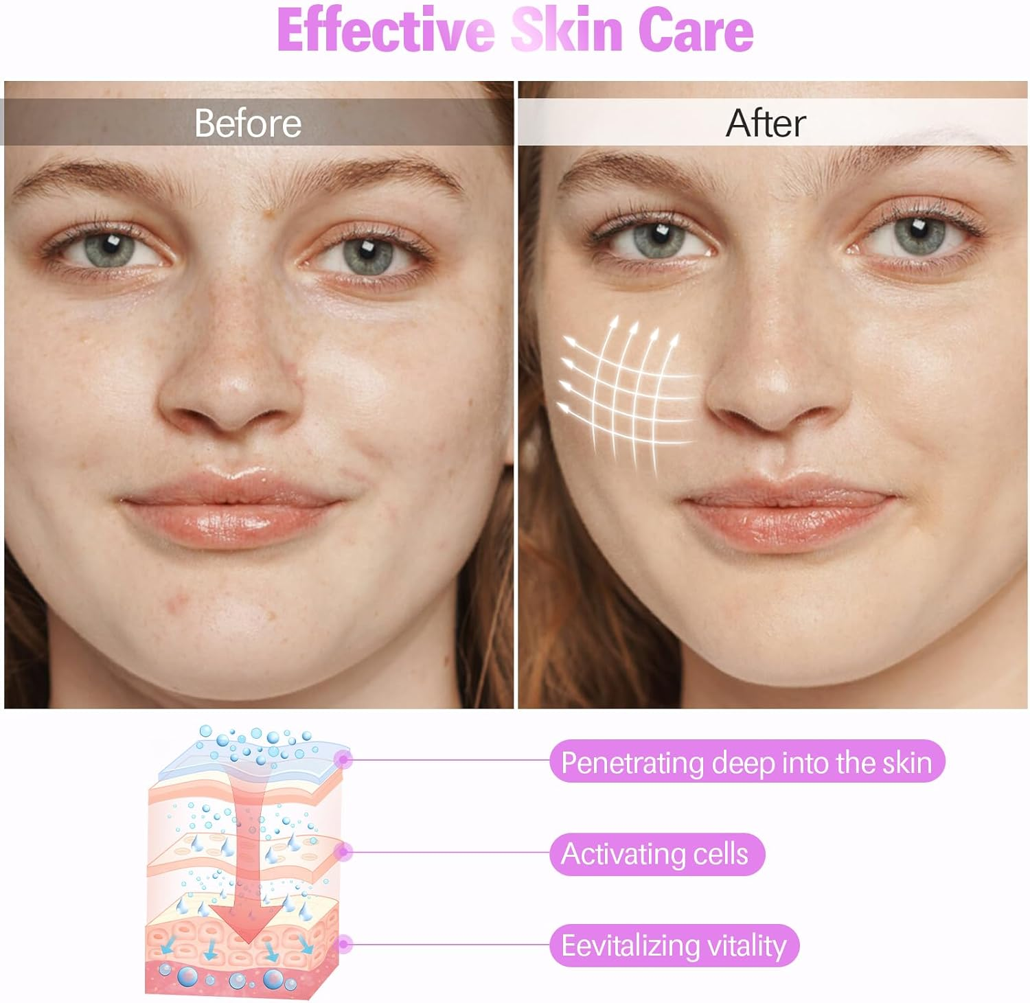 High Frequency Stick Face Portable Hand Electrode Stick Glass Tube Skin Therapy Device with 4 Argon Rods - Acne Treatment - Skin Tightening - Wrinkle Reduction image number 5