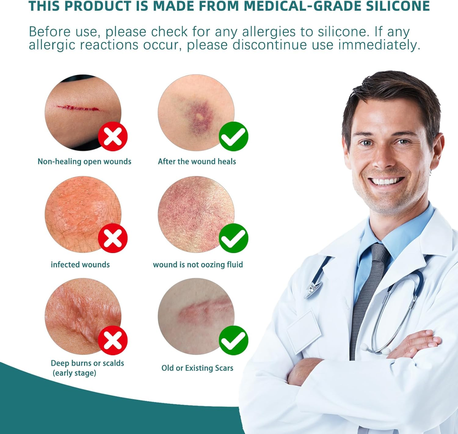 Silicone Scar Tape for Surgical Scars: Medical Grade Scar Gel Sheets for C-Section Tummy Tuck Recovery and Treatment &ndash; Reusable Scar Strips for Keloid Burn Acne Scars Removal (1.6'' X 60''Roll-1.5M) image number 5