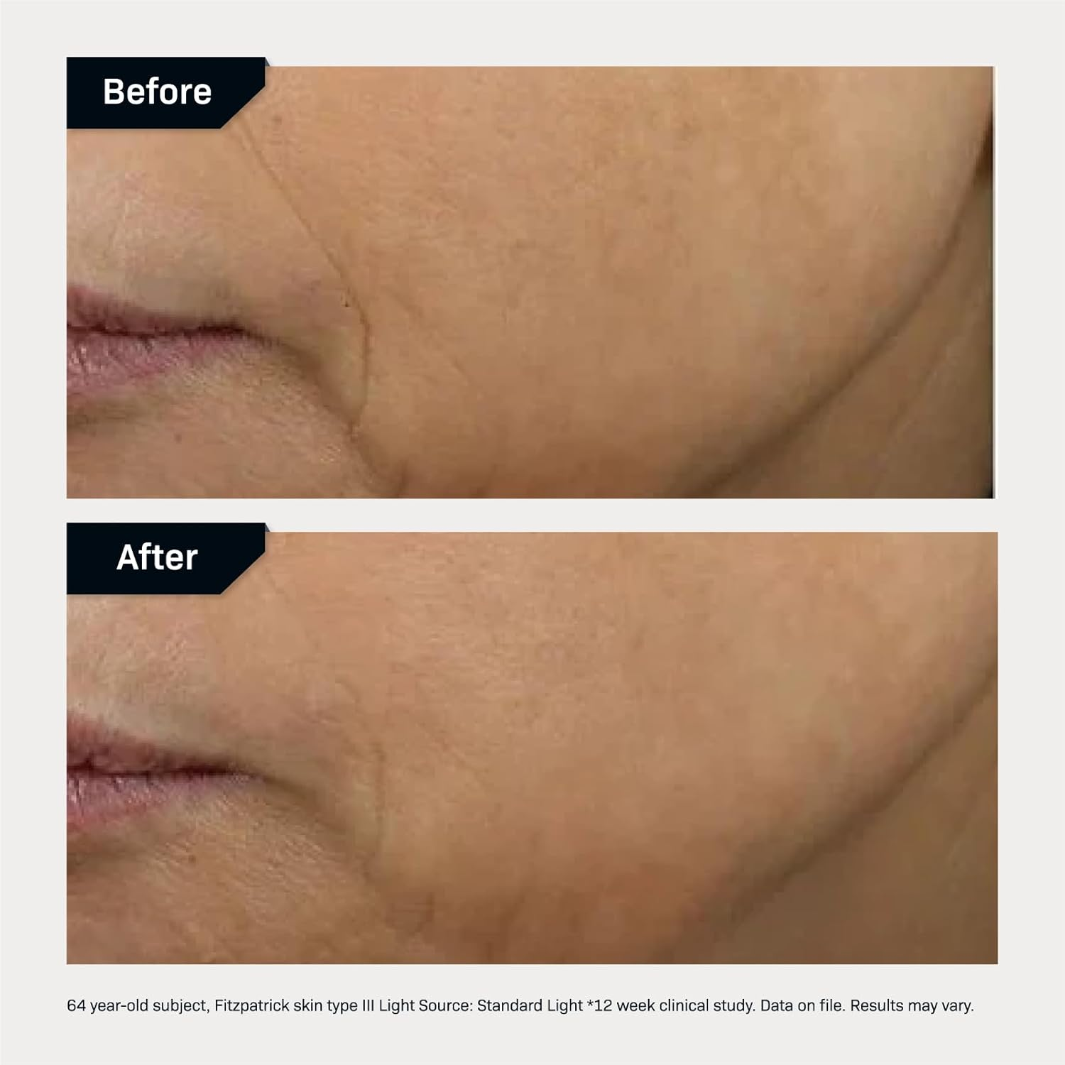 Revision DEJ Face Cream, 48 G image number 6