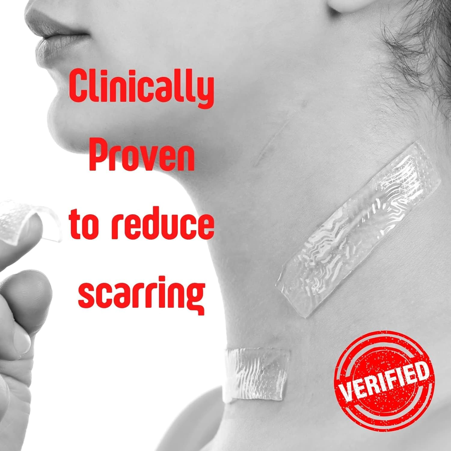 Silverseal Burn and Wound Dressing | Hydrogel Pads with X-Static Silver | Soothing, Moist & Protective | Burns, Cuts & Wounds | 4 Sterile Dressings image number 1