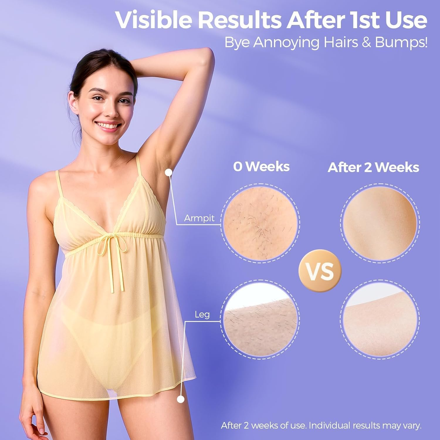 APEXORIGIN Laser Hair Removal with 5℃ Ice Cooling, Painless IPL Laser Hair Removal Device for Women & Men, 999,999 Flashes, 5 Levels, 2 Modes, Safe, Permanent At-Home Hair Removal for Face & Body image number 3