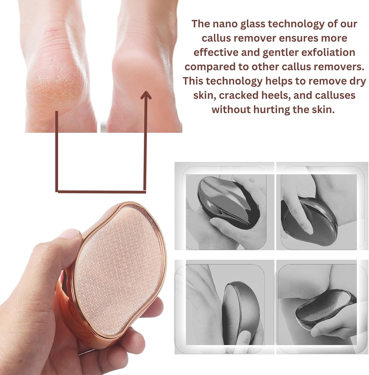 Pedicure Foot File Callus Remover 2 Pack, Portable Rustproof Glass Foot Scrubber Scraper Callous Shaver for Cracked Heel Hard Dry Skin of Feet Hand Elbows Knees (Golden) image number 5