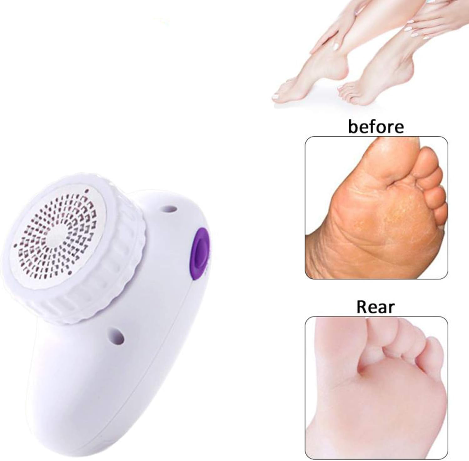 Electronic Foot File Rechargeable Callus Remover, Electric Foot File,Portable Foot Pedicure Hard Skin Removal - for Velvet-Smooth Foot Care image number 2