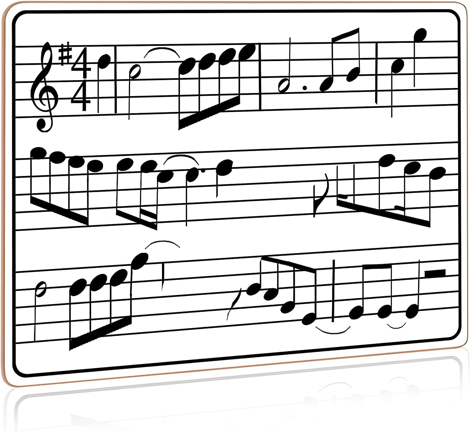 Scribbledo 24 Pack Dry Erase Music Staff White Boards 9" X 12 Inch Lapboard Double Sided Musical Notes Whiteboard for Kids Students, Musicians and Home Erasers Included