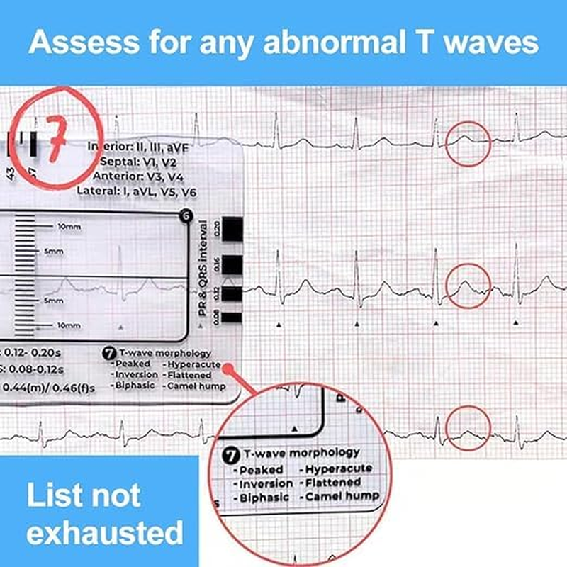 ECG 7Step Ruler,Ecg Ruler Plastic Ruler Measuring Tool,Ecg 7Step Ruler for ECG/EKG Interpretation,Transparent EKG Calipers 7Step Ruler,Follow a 7Step Plan ID Sized for Nurse or One in Healthcare (2) image number 5