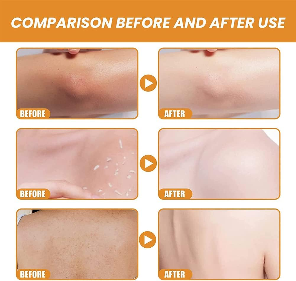 Gmeelan Orange Exfoliating Whitening Gel, Orange Exfoliating Gel Scrub Face Body Skin Whitening, Deep Cleaning Exfoliating Whitening Gel (3PCS) image number 4