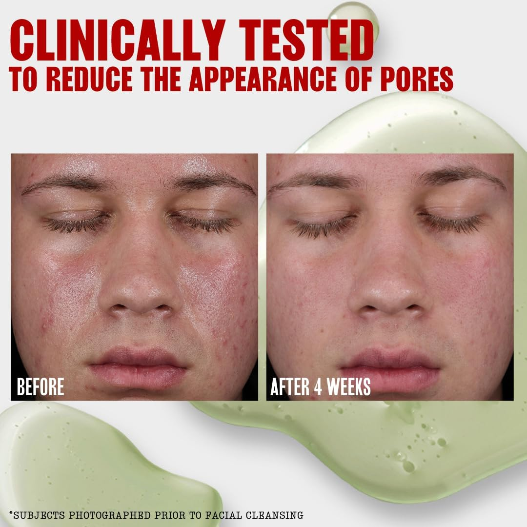 Thayers Oil Balancing Jelly Toner with Kombucha Filtrate & 2% Niacinamide 355 Ml image number 3