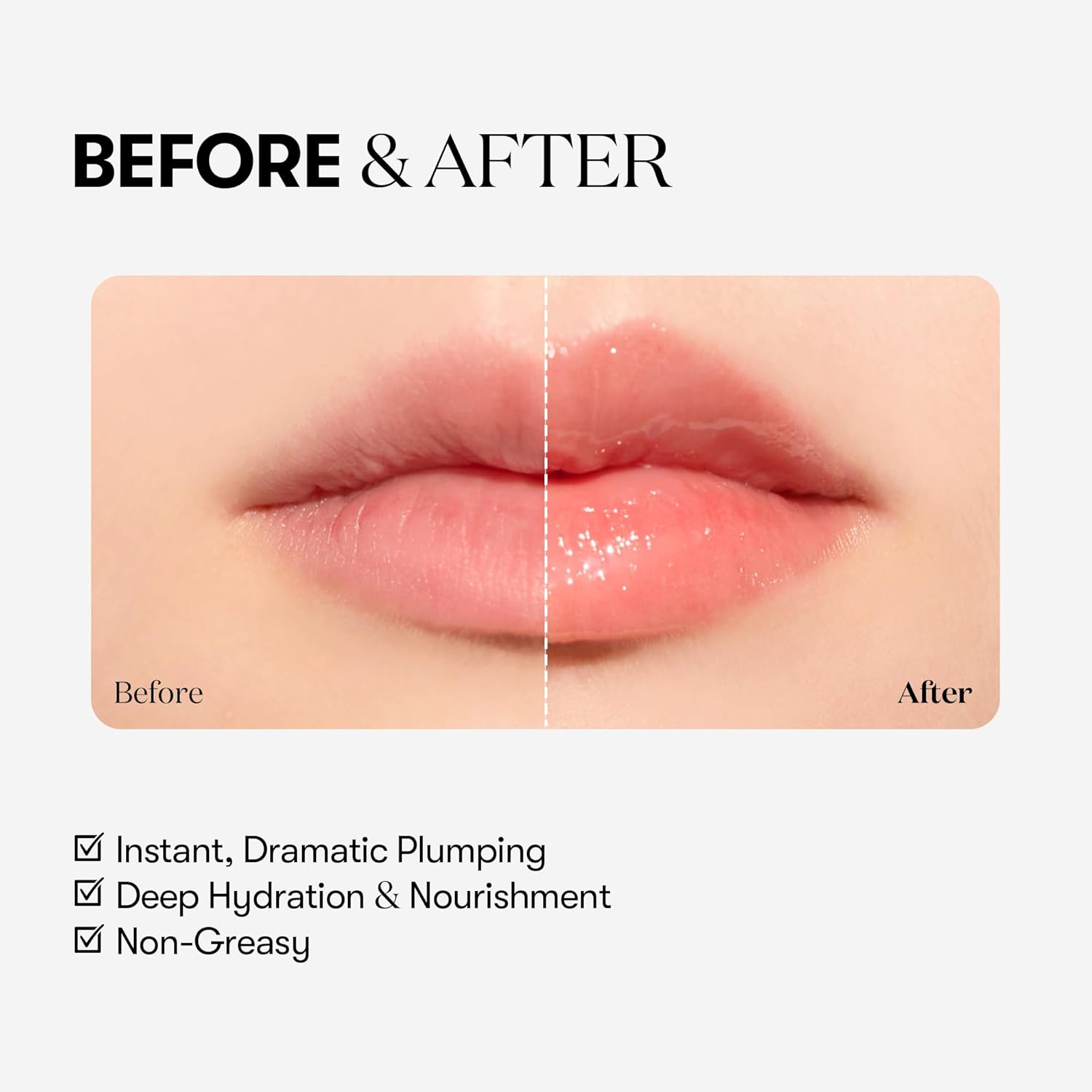 VTCOSMETICS Reedle Shot Lip Plumper(Expert) image number 3