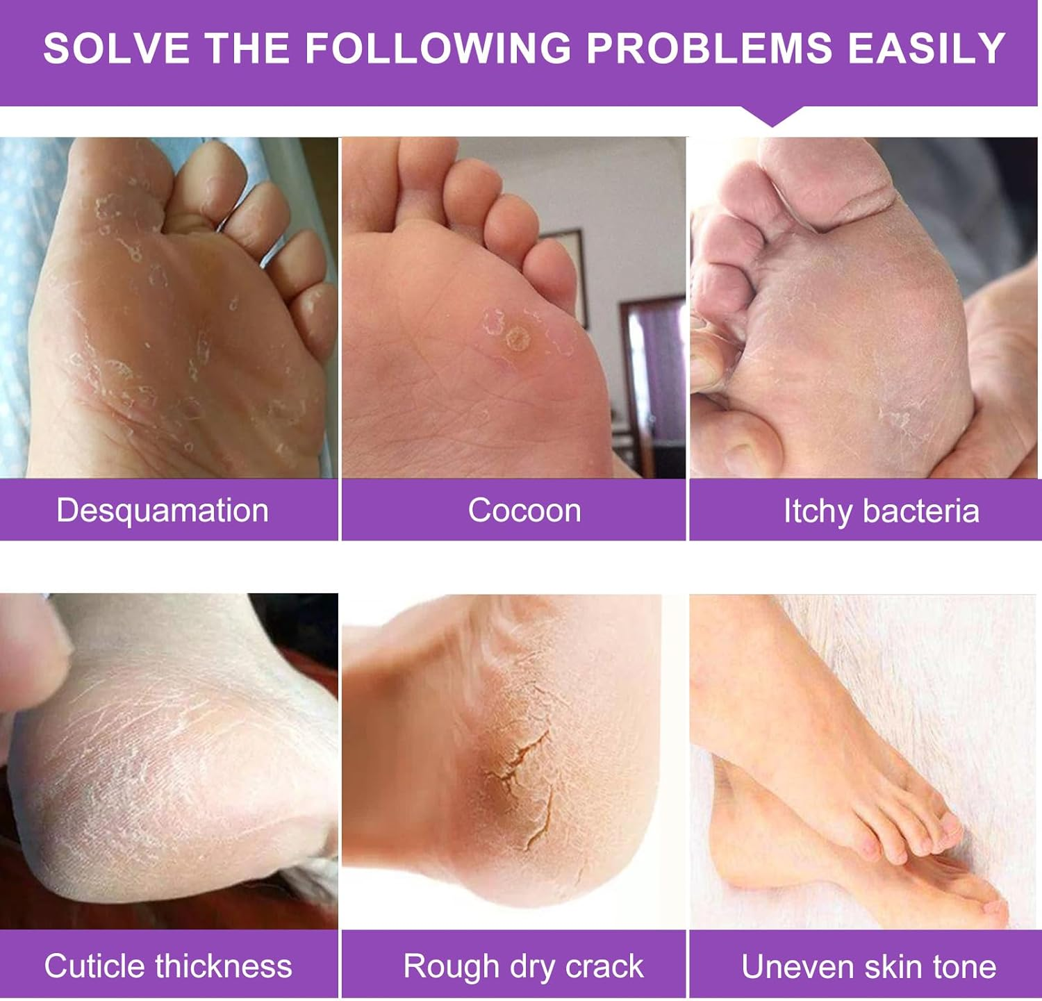 Foot Peel Mask 4 Pack, Exfoliator Peel off Calluses, Exfoliating Foot Care,Foot Exfoliator Repair Dry Cracked Feet,Peeling Away Dead Skin, Calluses, Dead Skin Callus Remover, Baby Soft Smooth Touch Feet-Men Women (Lavender) image number 3