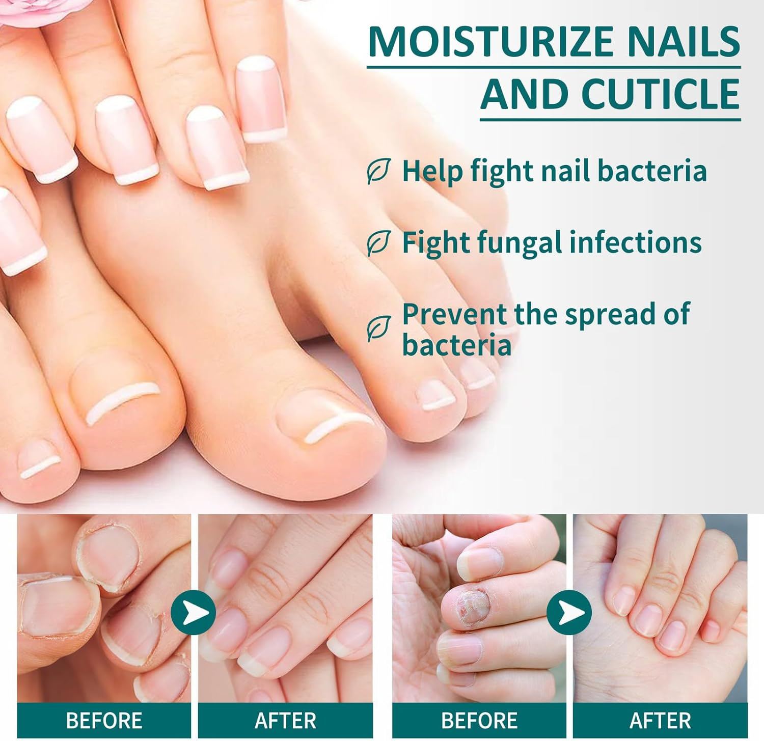 Nail Care Pen, Nail Care Pen Nail Fungus Pen Steiger Naturals Nail Care Pen Nail Fungus Pen Austria (Pack of 5) image number 2