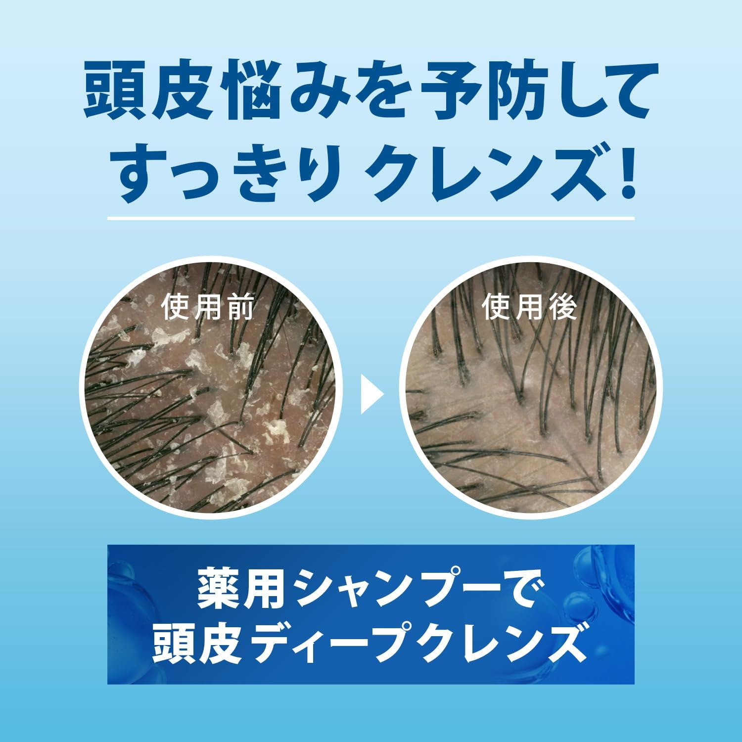 H&S Moisture Medicated Conditioner, Refill, Extra Large, 4.9 Lbs (2.2 Kg), Large Capacity, for Dryness, Itchy, Dandruff and Tasty Hair image number 2