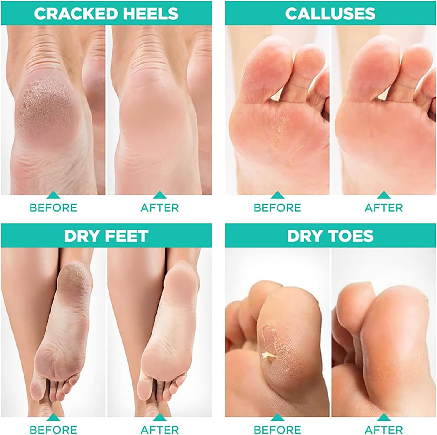 3 Pairs Foot Peel Mask, Repair Cracked Heels & Remove Dry Dead Skin for Soft Baby Foot Effect, Callus Remover, Foot Exfoliating Socks for Hard Skin, Foot Treatment for Men and Women - Lavender