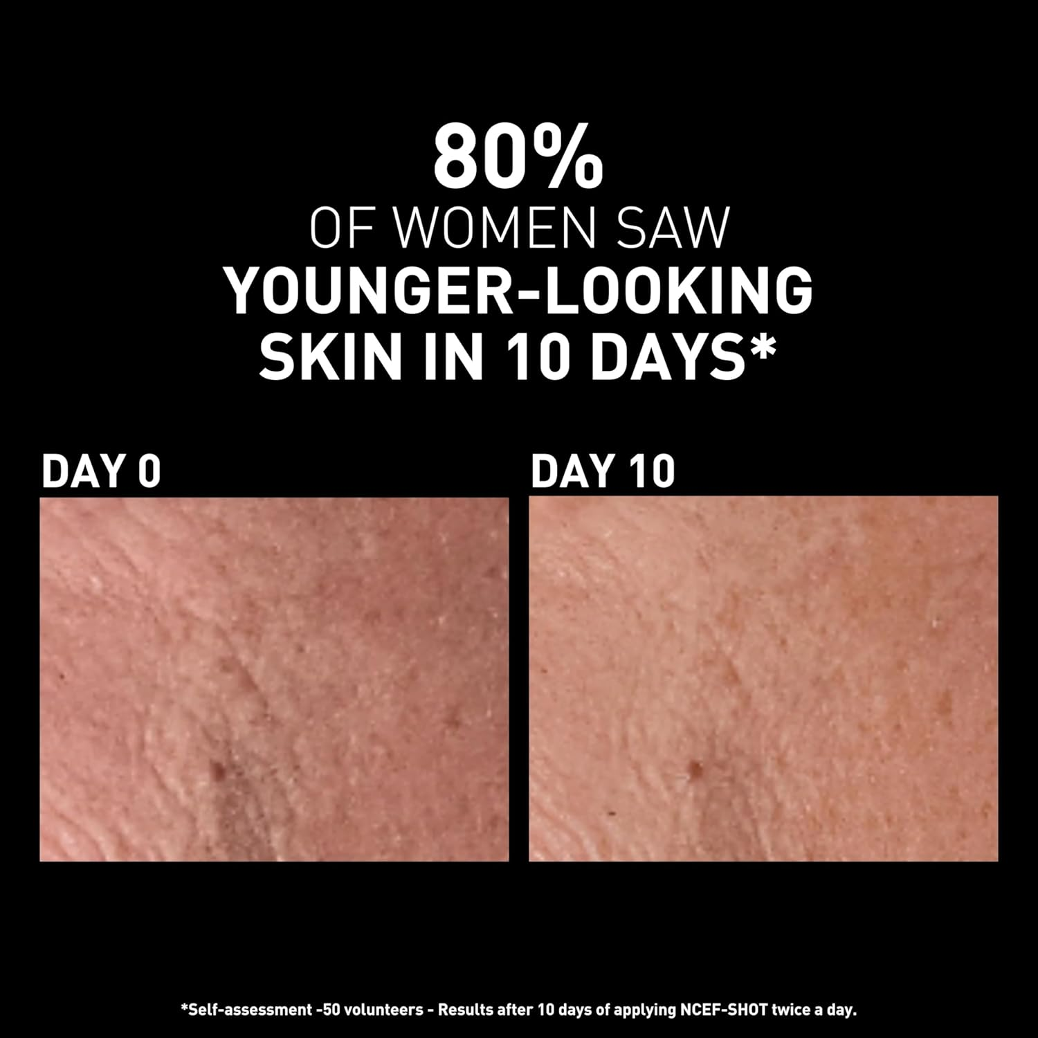 Filorga Ncef-Shot Anti-Aging Serum, Concentrated Wrinkle Reducing Treatment for Radiant & Firm Skin in 10 Days, 0.5 Fl. Oz. image number 1