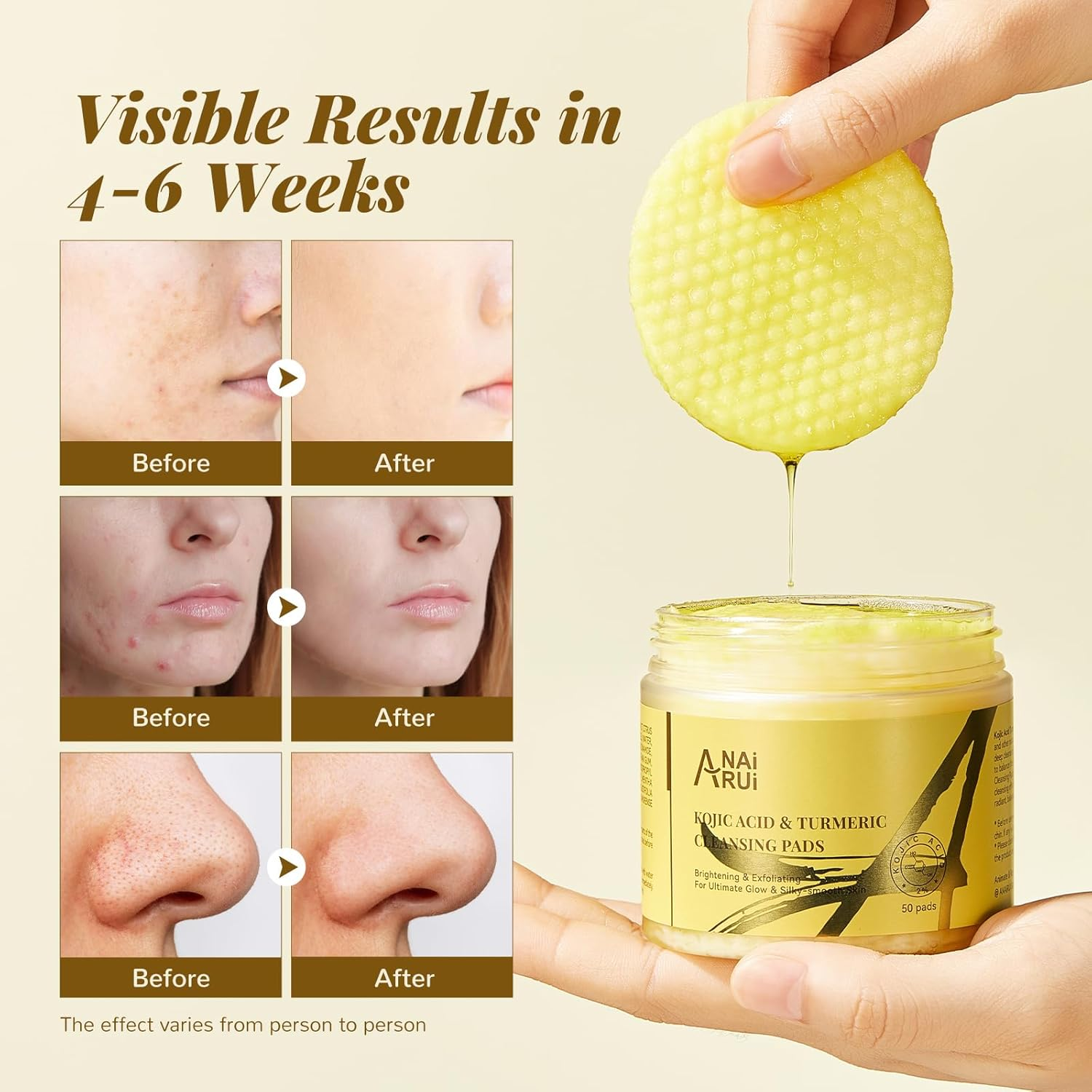 ANAI RUI Turmeric Kojic Acid Exfoliating Cleansing Pads, Deep Cleansing Brightening Pads, Exfoliating Scrub Pad for Face and Body, Acne Treatment, Make-Up Remover Wipes, 50 PCS image number 4