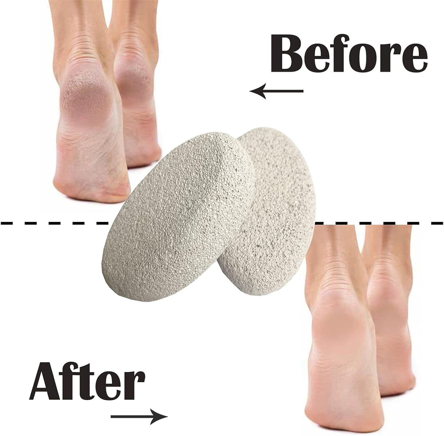 2 Pieces Natural Pumice Stone for Feet Foot Care Hands Body Pedicure Pedicure Exfoliating Tools for Dead and Hard Skin