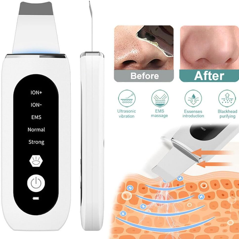 Havvo Ultrasonic Facial Skin Scrubber Face Pore Deep Cleaner Spatula Blackhead Remover image number 4