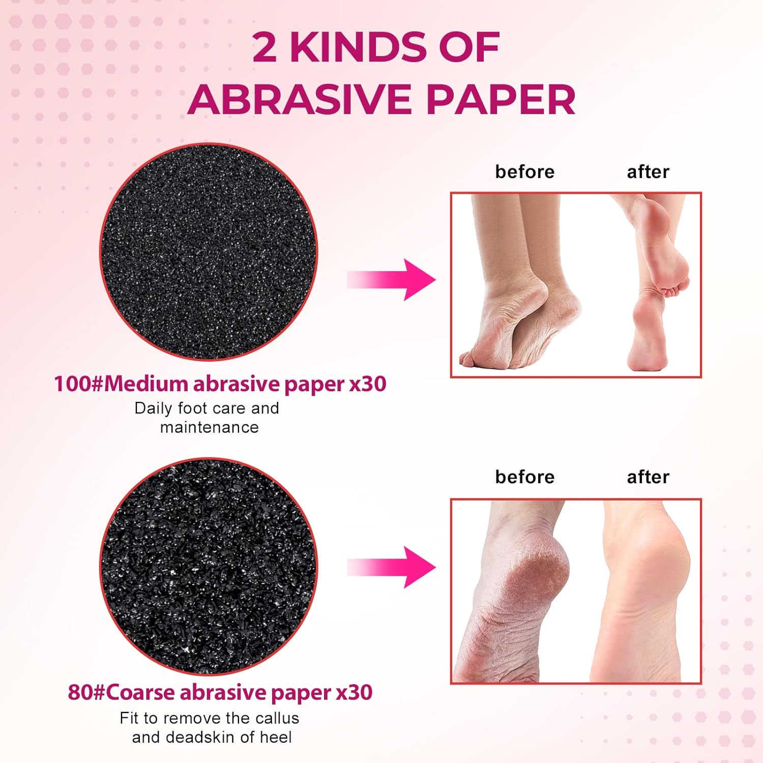 Krofaue 60 PCS Replaceable Sandpaper Discs - 80 & 100 Grit Pad Refills for Electric Foot File Callus Remover - Dead Skin and Calluses Removal image number 4