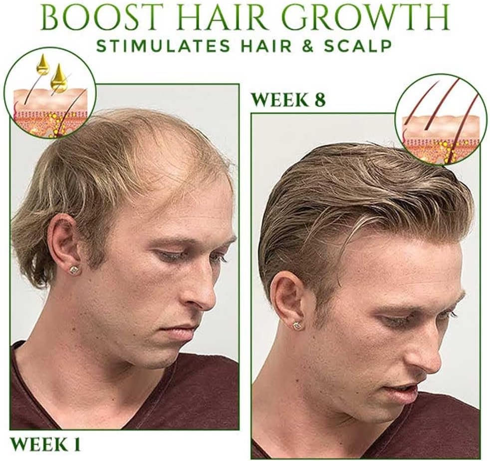 Red Ginseng Hair Growth Spray,Hair Growth Spray Natural Herbs Ginseng,Ginger Spray Serum for Women & Men (2Pcs) - 2Pcs image number 3