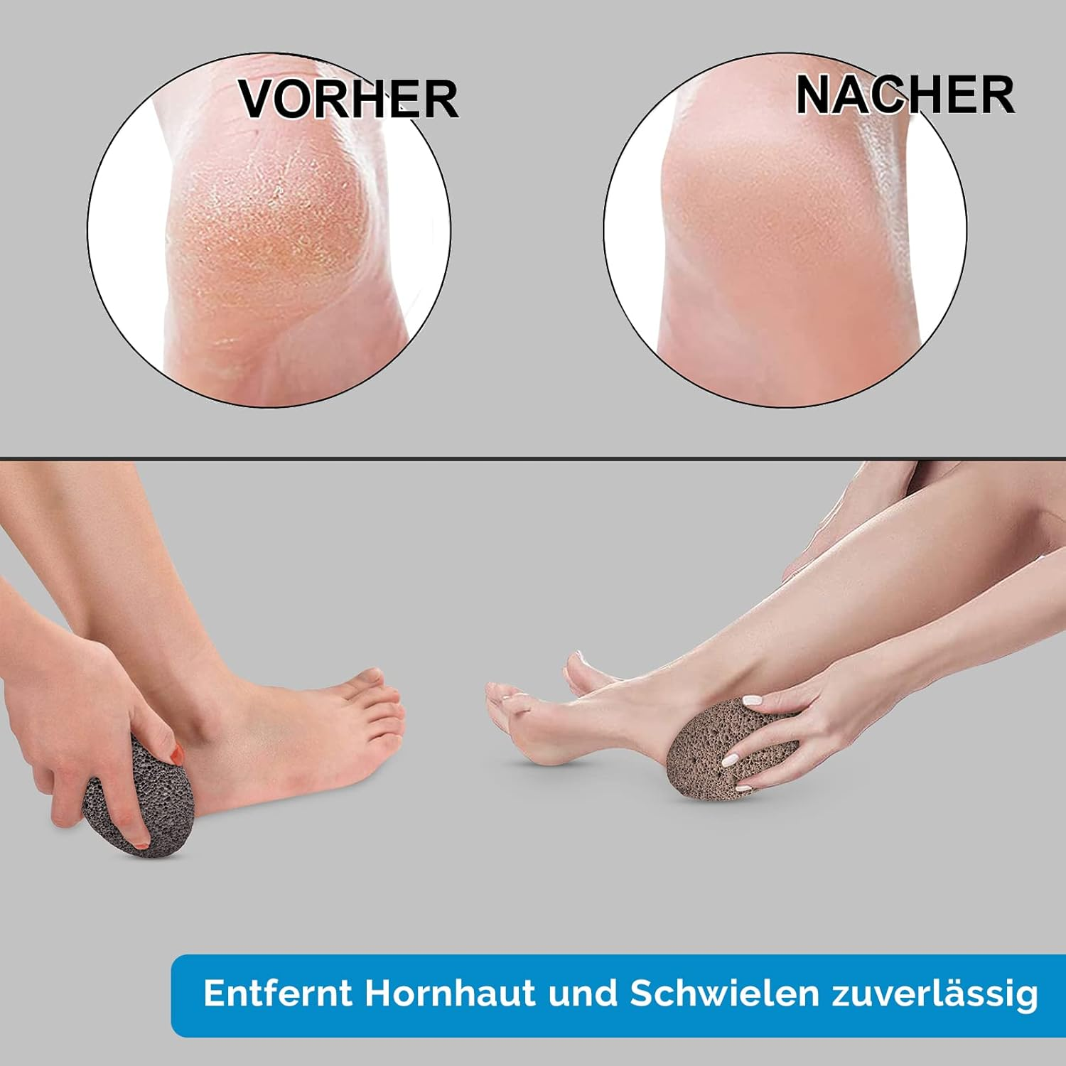 Holbeauty&reg; Pumice Stone - Natural Lava Stone - Callus Remover - Pumice Stone - Callus Remover - Foot Care - Terracotta and Dark Grower (Dark Grower) image number 2