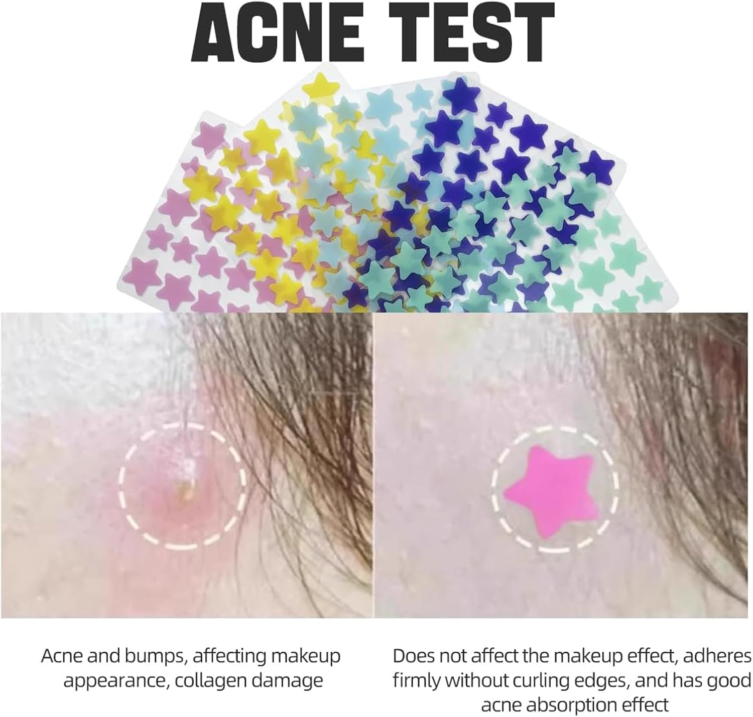 200-Pcs Pimple Patches with Hydrocolloid & Tea Tree Oil,Star Design，Hydrocolloid & Tea Tree Oil Pimple Patches with Invisible Stars (24H Use) image number 3