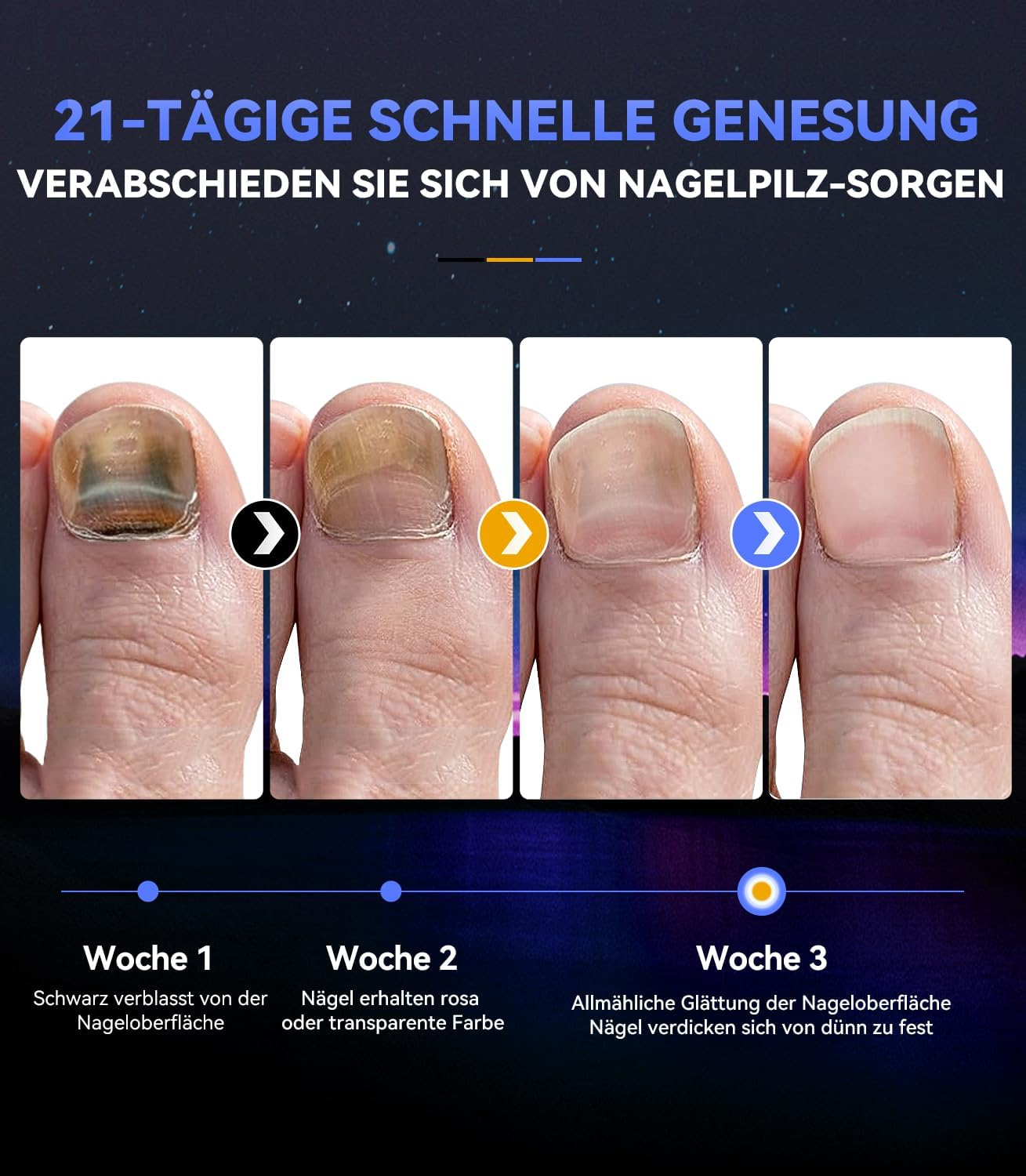 IUHFSIFS 5.0 Fingernails - Intelligent 3/5/7/10Min Timer Function Timing Device Equipment for Home Use, Both Hands/Feet Can Be Used Simultaneously Laser (Pink) image number 1