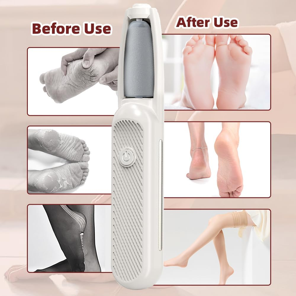 Electric Callus Remover, Electric Callus Remover with 6 Grinding Heads, 3 Speeds, Rechargeable Electric Callus Remover Feet, for Dead, Hard, Cracked Skin (White)