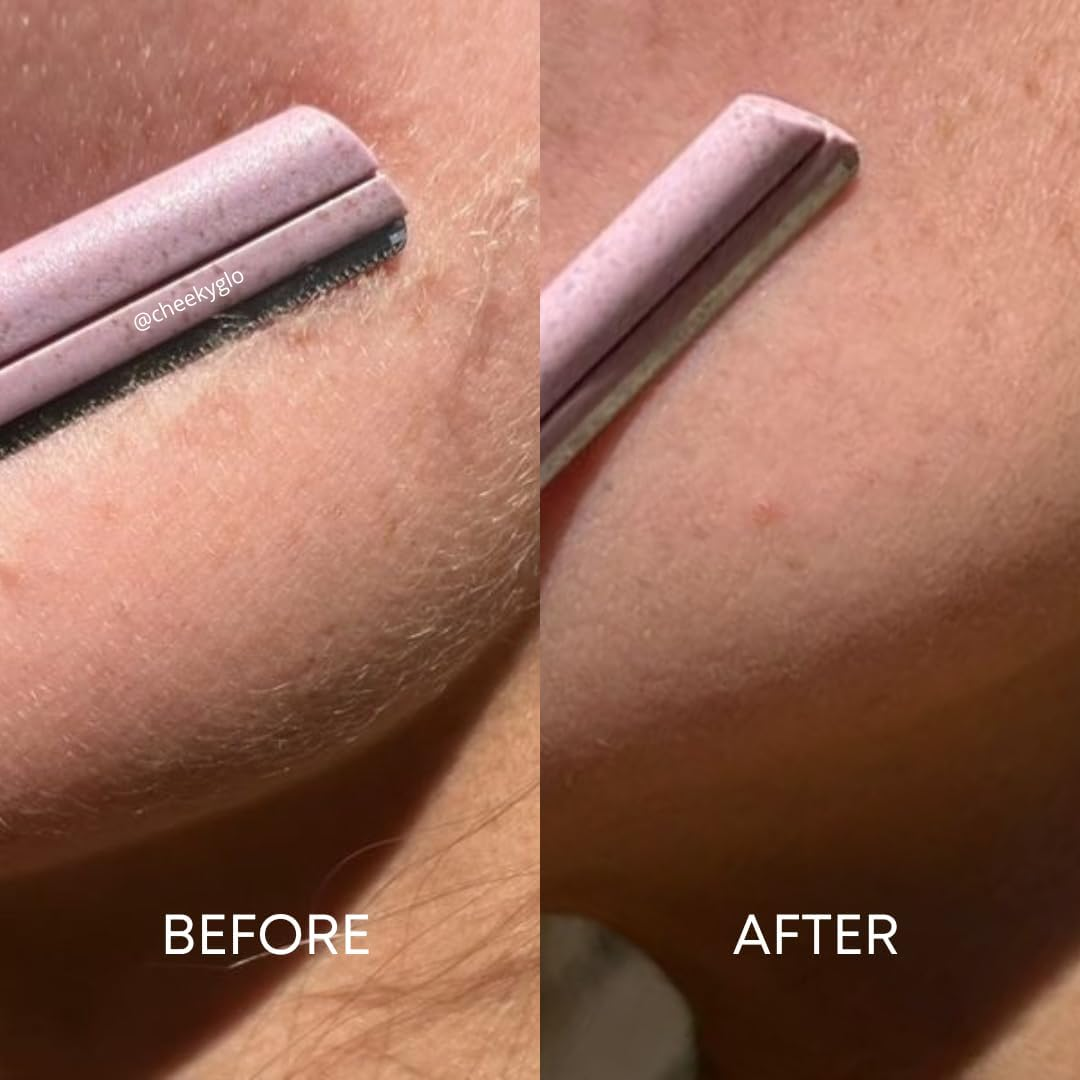 Cheekyglo Dermablade (3-Pack) | Dermaplane Razor | Eyebrow Razor | Face Shaver | Peach Fuzz Removal | Facial Hair Shaver | Stainless Steel Safety Razor | Face Exfoliator | Biodegradable Easy to Use image number 1