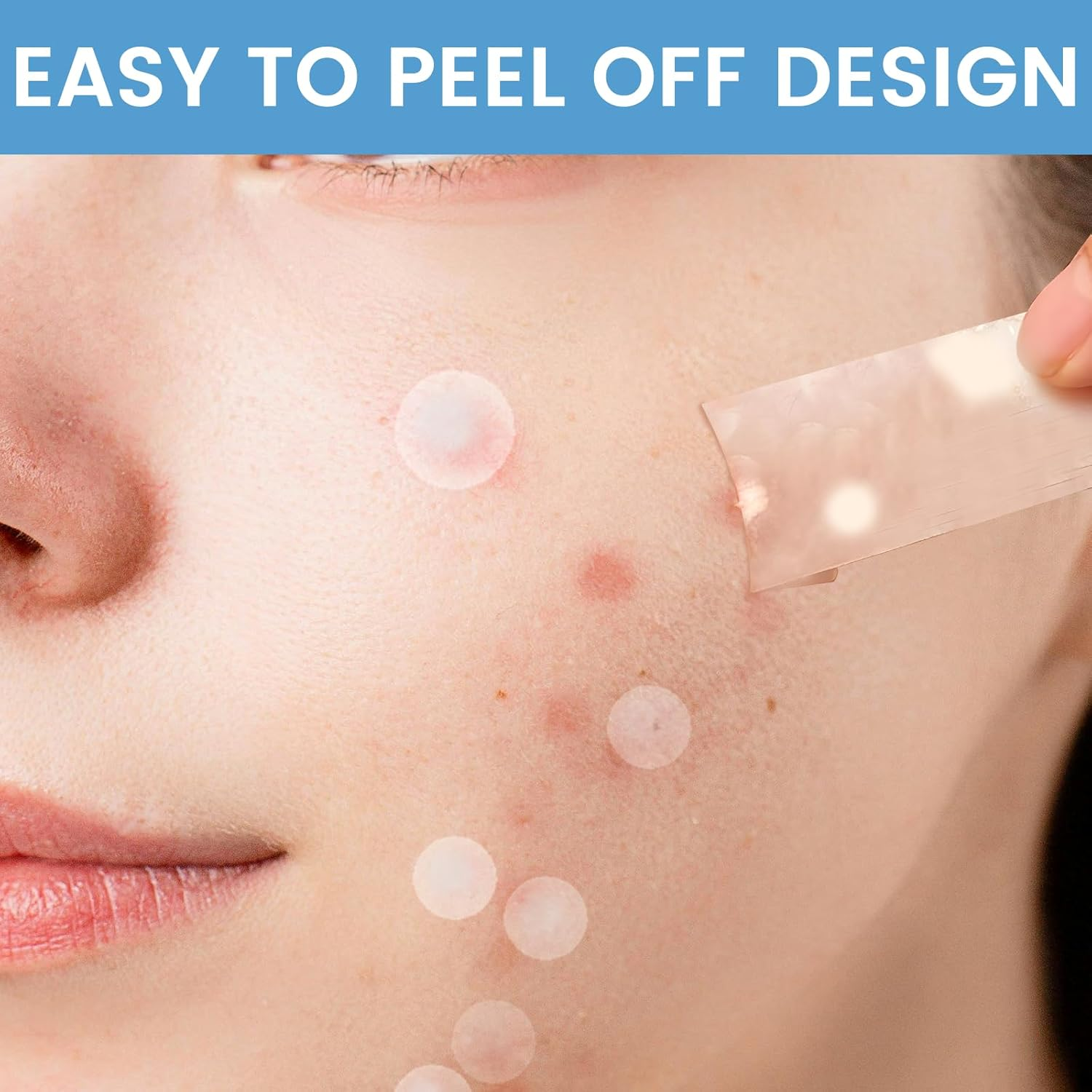 Large Pimple Patches for Face & Body, 7 Sizes Acne Hydrocolloid Bandages for Zit Breakouts, Chin, Forehead, Chest, Back, 302 Count, Effective Acne Treatment(7 Sizes 302 Count) image number 6