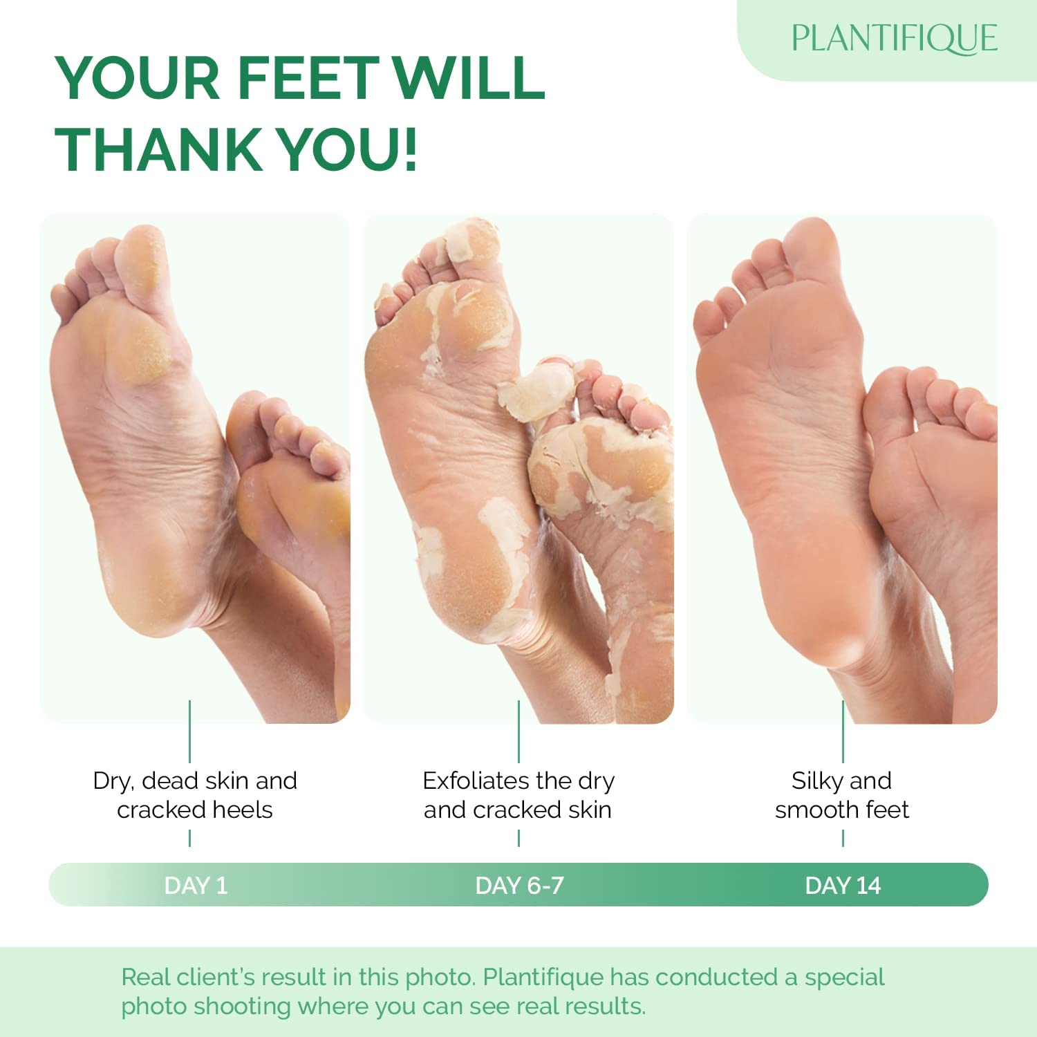 PLANTIFIQUE Foot Peeling Mask 4 Pack | Dermatologically Tested Repairs Heels & Removes Dry Dead Skin for Baby Soft Feet | Exfoliating Foot Peel Mask for Dry Cracked Feet image number 6