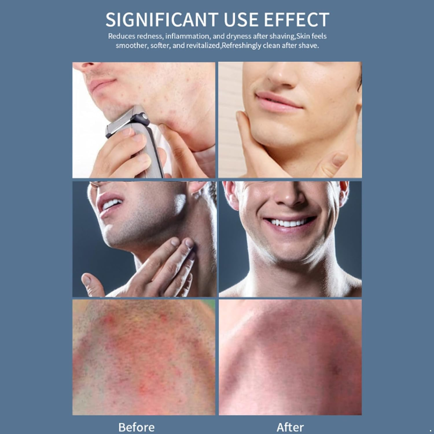 Riismen after Shave Calming Toner Spray for Men, 150Ml Formula for Oil Control and Skin Moisturizing Black One Size image number 6