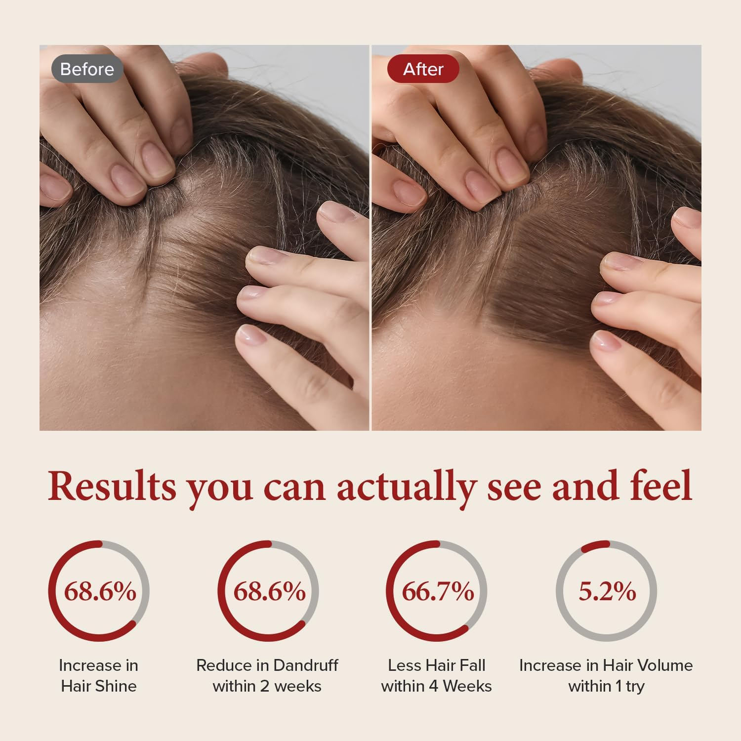 KUNDAL Natural Caffeine Scalp Shampoo [Cherry Blossom] Korean Hair Care, K-Beauty, Deep Cleansing, Scalp Care, for Thinning Hair, Helps Thickening, Scalp Care & Hair Strengthening, Natural Coffee Beans, Hydration, All Hair Types, for Men and Women 16.9Fl Oz