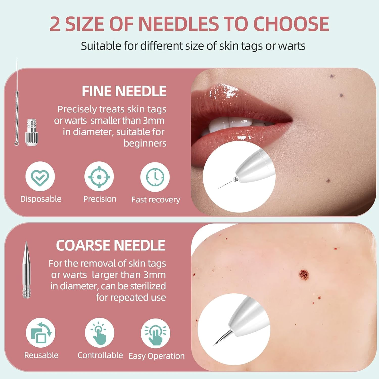 AL-40 Skin Removal Kit, Design to Smooth Your Skin, Safe and Effective for Home Use, Easy to Use Skin Tag Remover Kit image number 5