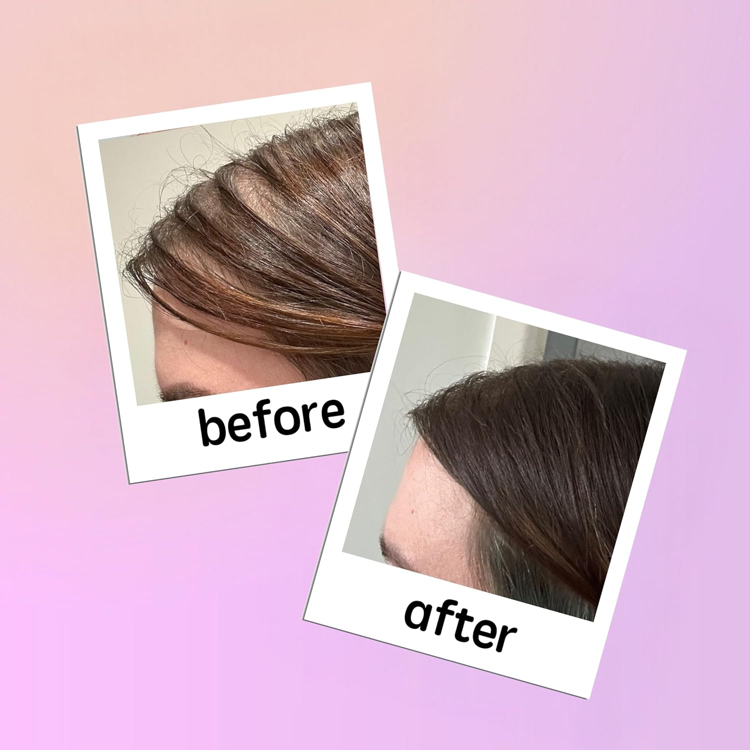 Georgiemane Hair Growth Capsules | Hair Regrowth Supplement with Biotin & Zinc Glycinate to Support Hair Growth | Helps Reduce Hair Thinning & Boosts Scalp Health | 120 Vegan Capsules - 60 Days Usage image number 3