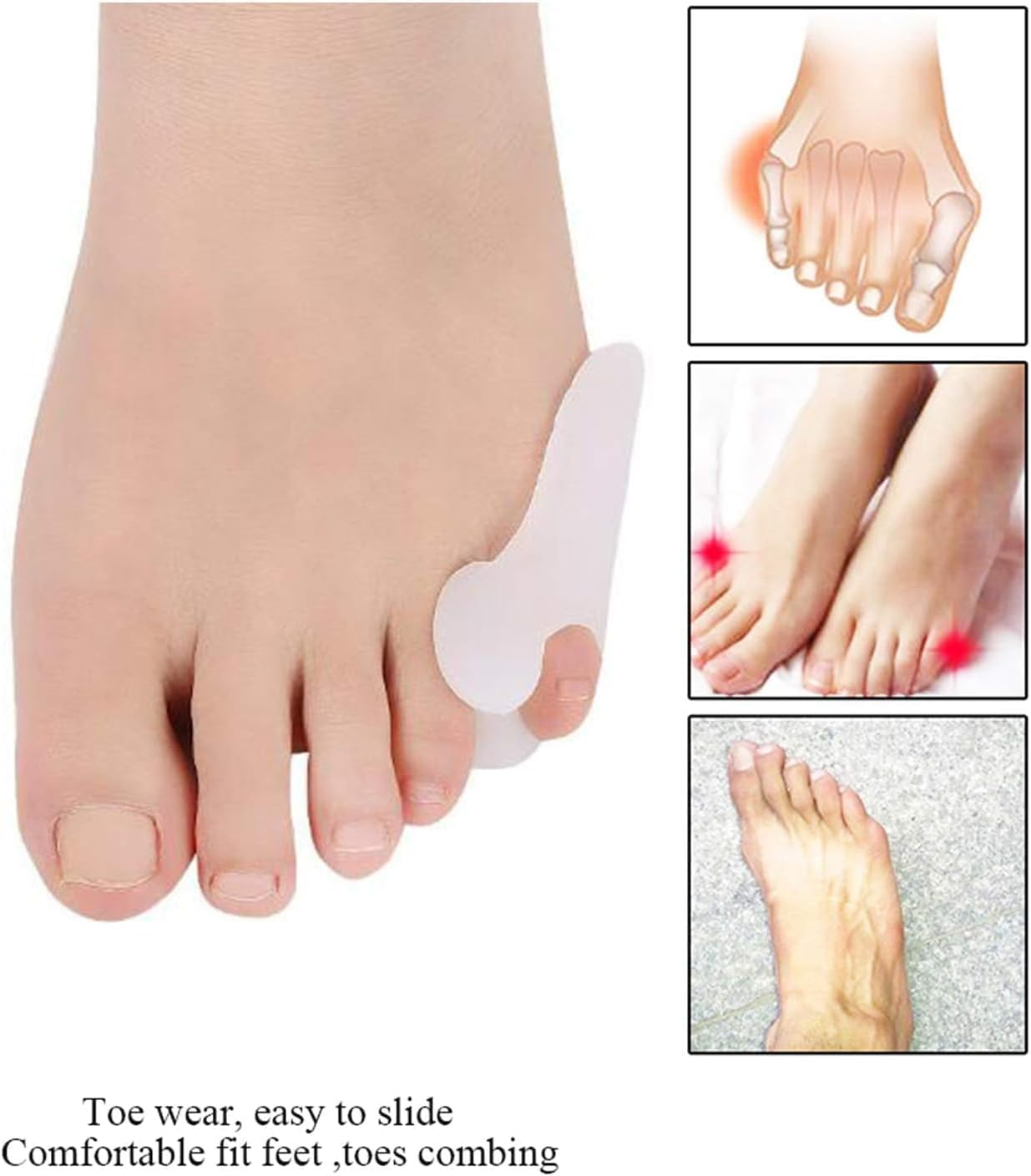 10 Pcs Little Toe Protector Toe Separators, Pinky Toe Bunionette Corrector, Toe Straighteners Spreaders, Bunionette Protect, Pain Relief and Overlapping Orthotics image number 3