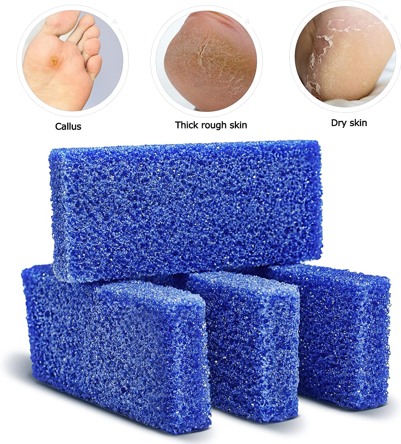 Disposable Foot Scrubber Sponge Pads Pedicure Pumice Stone for Feet Callus Remover Coarse Blue 40Pcs