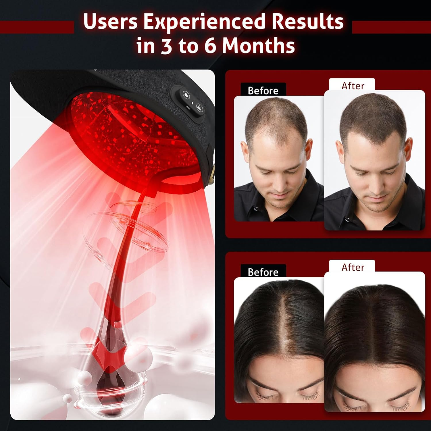 Laser Cap for Hair Growth, Red Light Therapy for Hair Growth, Strengthen Hair Roots, Hair Loss Treatment for Men and Women image number 2