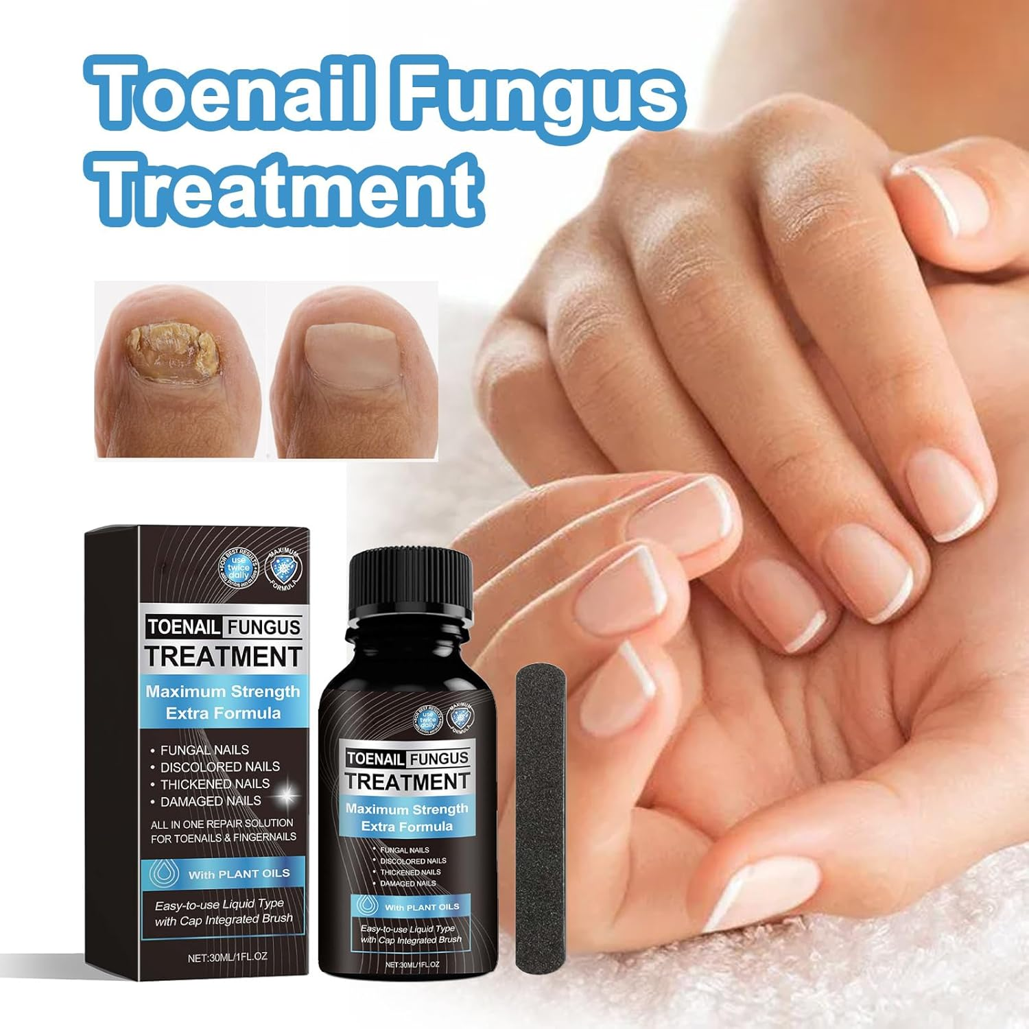 30ML Fungal Nail Treatment for Toenails & Fingernails to Improves Brittleness & Discoloration, Nail Tending for Stronger, Healthier-Looking Nails image number 2