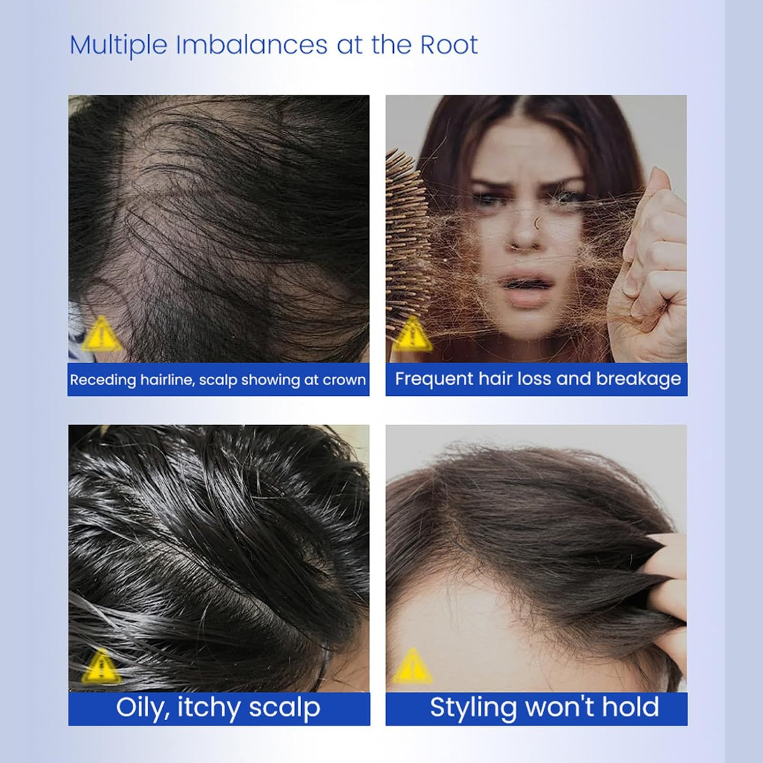 Hair Growth Serum with Roller Applicator - 30Ml Scalp Treatment for Thinning Hair - Strengthening & Nourishing Hair Care Essence for Men & Women image number 1