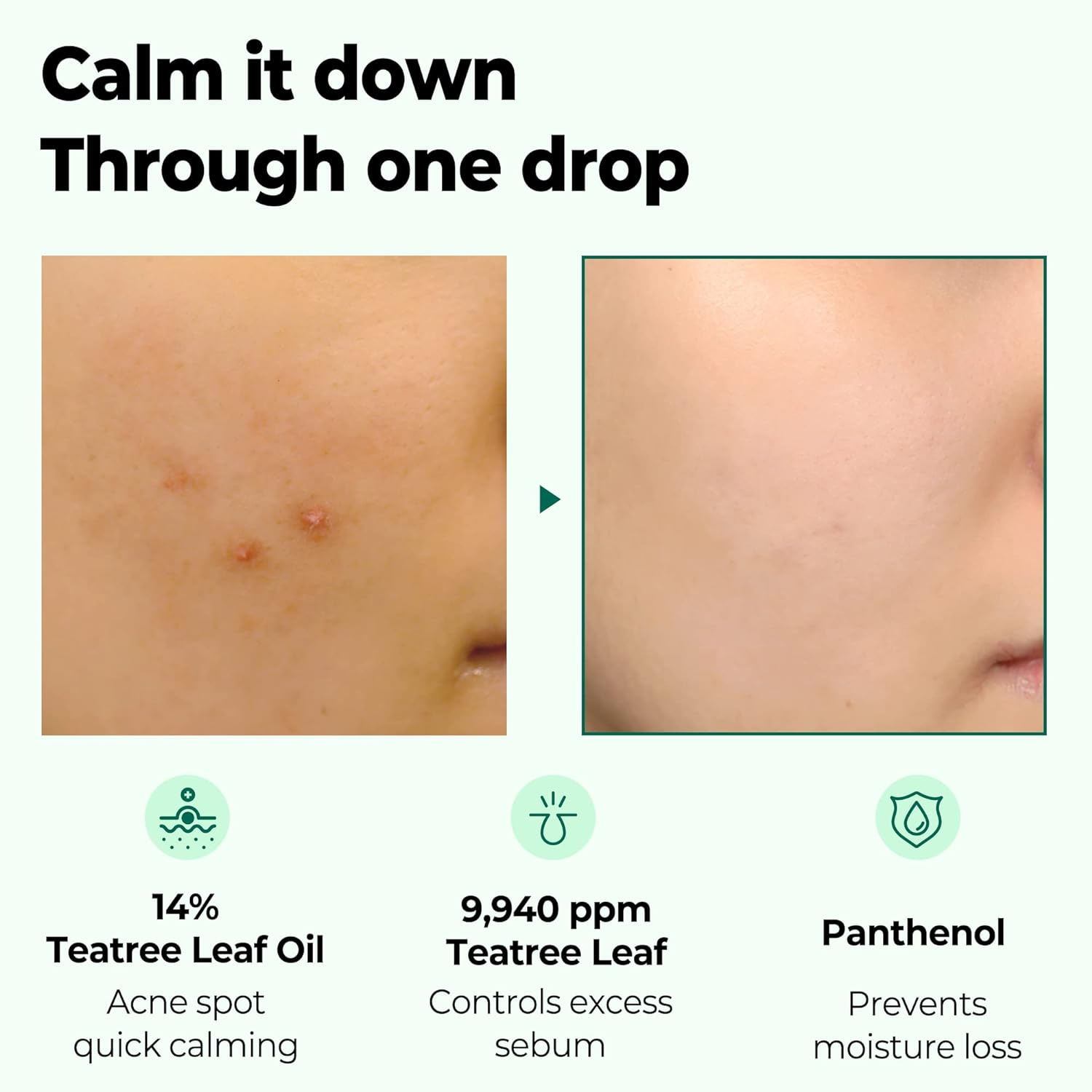 SOME by MI 30 Days Miracle Tea Tree Spot Oil image number 3