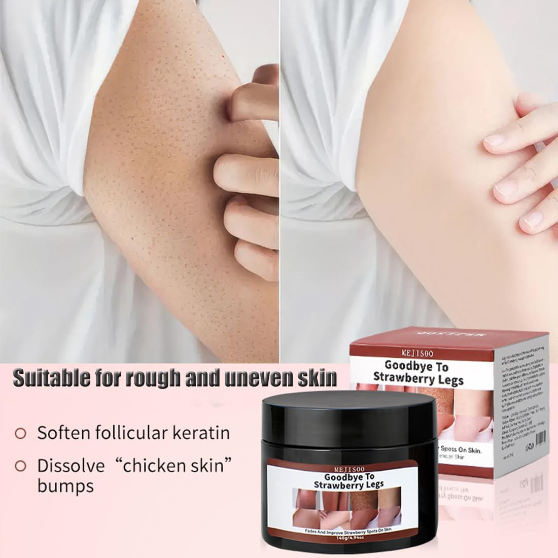 Goodbye to Strawberry Legs Cream-Strawberry Legs Treatment,Ultra Strength Exfoliating Body Lotion Hydrating Chicken Skin Treatment,Keratosis Pilaris Moisturizing Women Men 4.7 Fl Oz (1 Set)