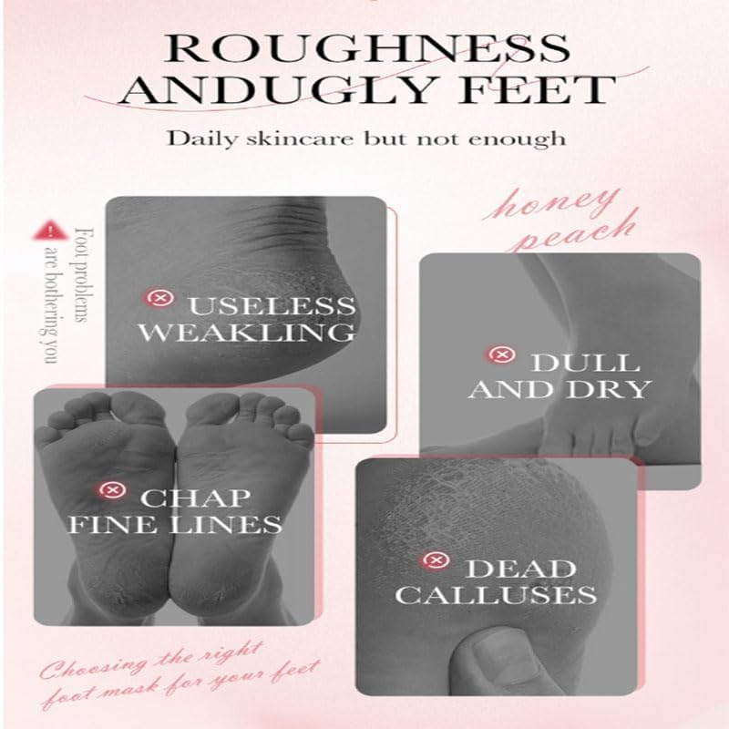 Whitening Foot Mask, Tender Skin, Moisturizing, Autumn and Winter Foot Care, Niacinamide Whitening Foot Mask 35G 1 Piece image number 1