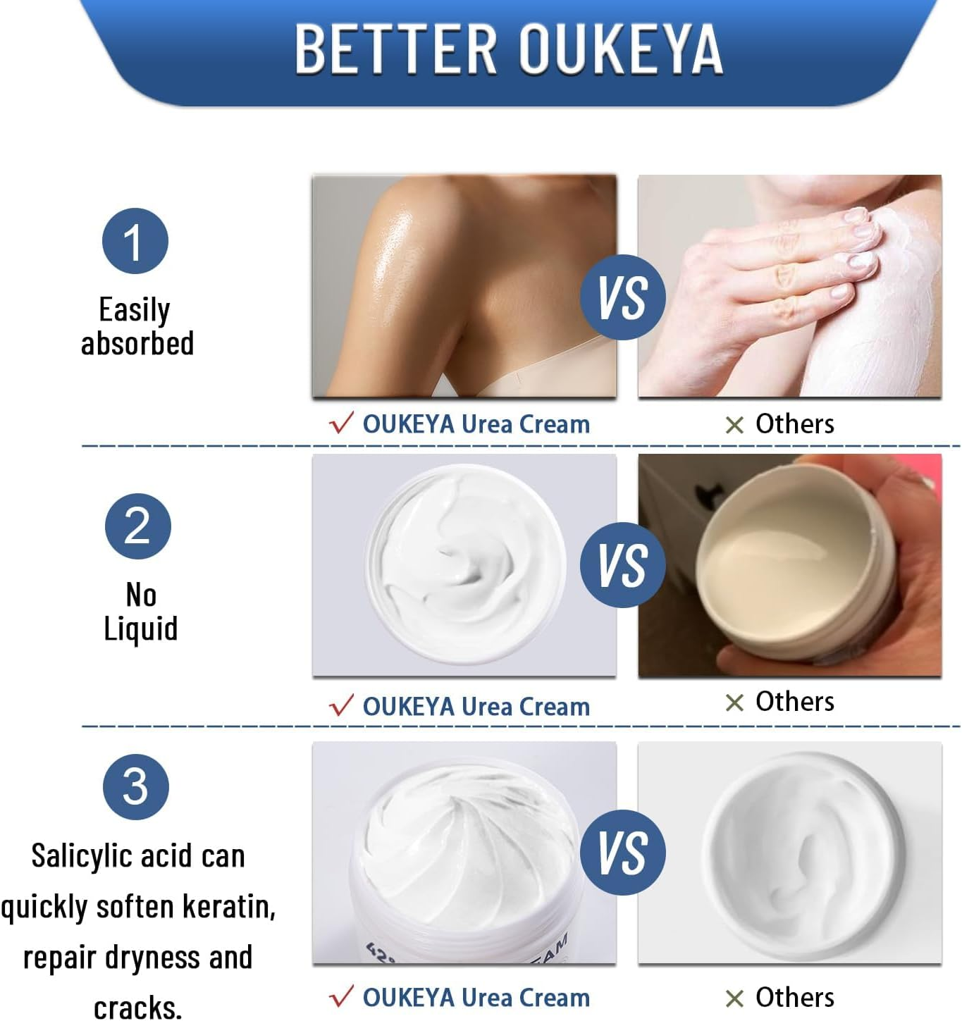 Urea Cream 42% plus Salicylic Acid 2% ，Keratolytic Foot Cream for Dry Cracked Heels, Feet, Knees, Elbows, Hands, Cuticle, Callus Remover, Skin Barrier Repair and Softens Toenails